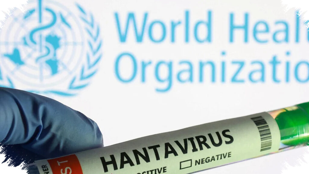 Pasien Israel Terinfeksi Hantavirus, Jenis Eropa Ini Masih Dalam Pengawasan Ketat