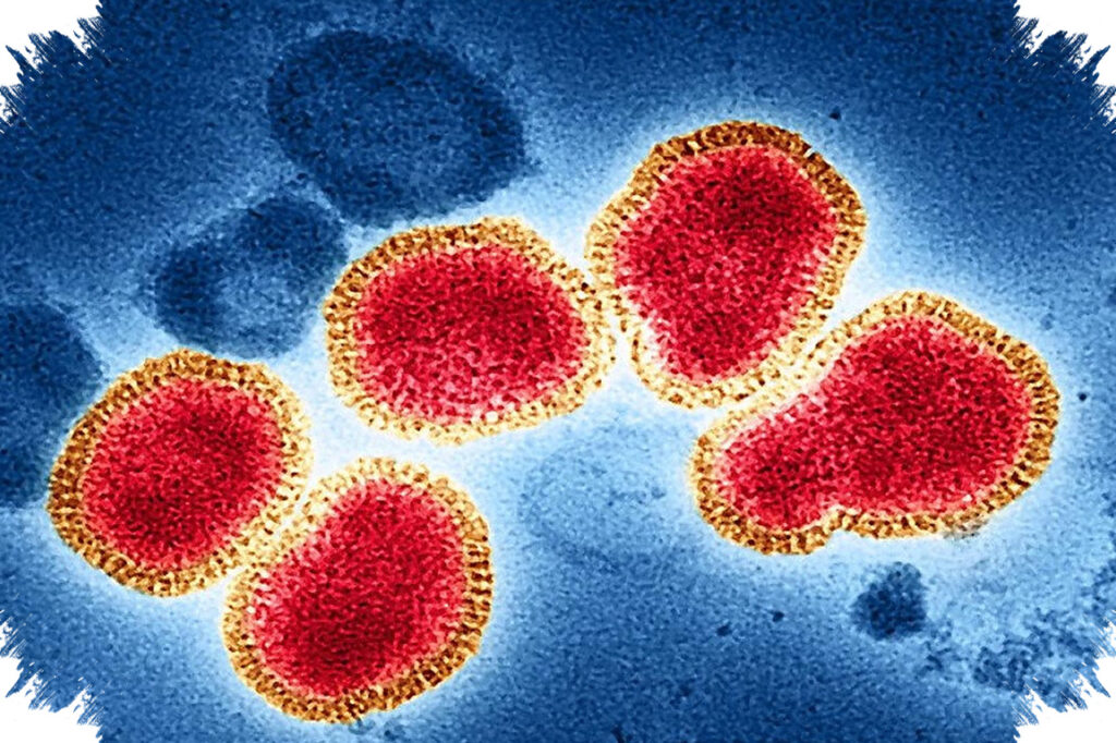 Demam dan Lemas Bisa Jadi Awal Hantavirus, Infeksi Tikus Ini Cepat Merusak Paru-Paru