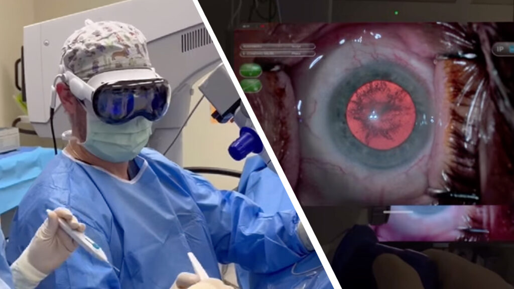 Di Ruang Bedah Katarak, Apple Vision Pro Dipakai Untuk Tampilan 3D Dan Data Langsung