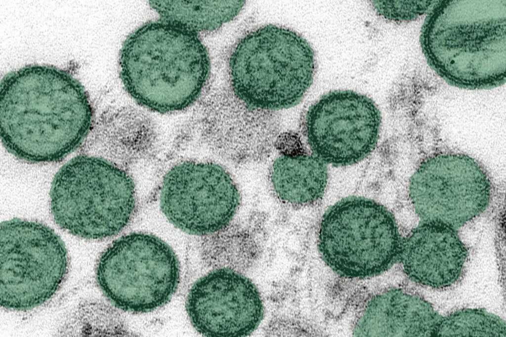Bukan Virus Baru, Hantavirus Sudah Lama Dipelajari Sejak Demam Misterius Perang Korea