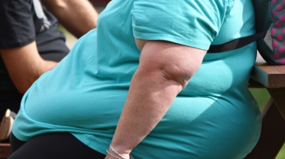 Operasi Bariatrik Tak Hanya Untuk Berat Badan, Ini Tanda Obesitas Mulai Berbahaya