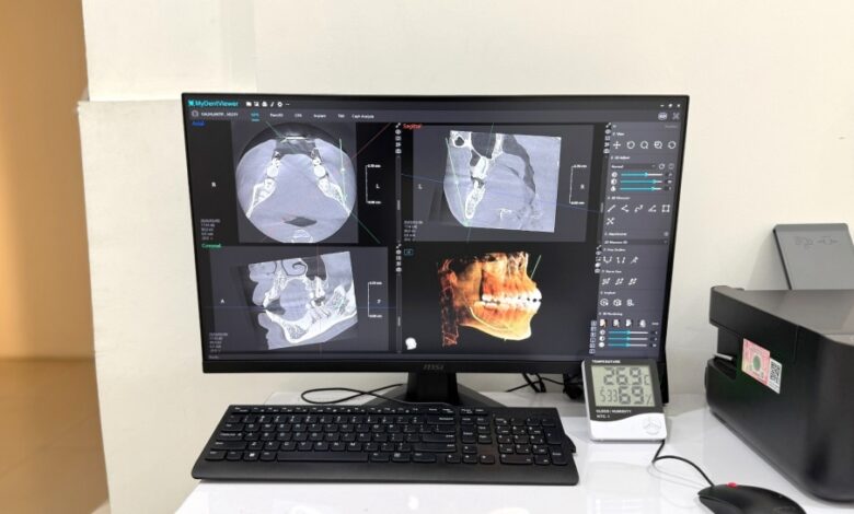 CBCT Baca Struktur Gigi Dan Rahang Lebih Rinci, Hasilnya Keluar Dalam Hitungan Menit