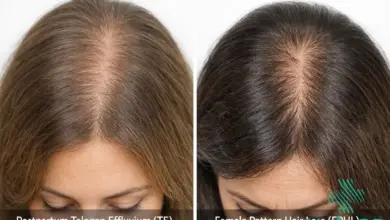 Baby Hair yang Sering Terlewat, Tanda Tubuh Mulai Pulih Setelah Melahirkan