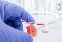 Terapi Stem Cell Makin Dekat Ke Pasien, Dari Perbaikan Kulit Sampai Sendi