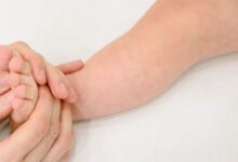 Skin Barrier Lemah Bikin Eksim Bayi Mudah Kambuh, Cara Menjaganya Bukan Sekadar Oles Pelembap