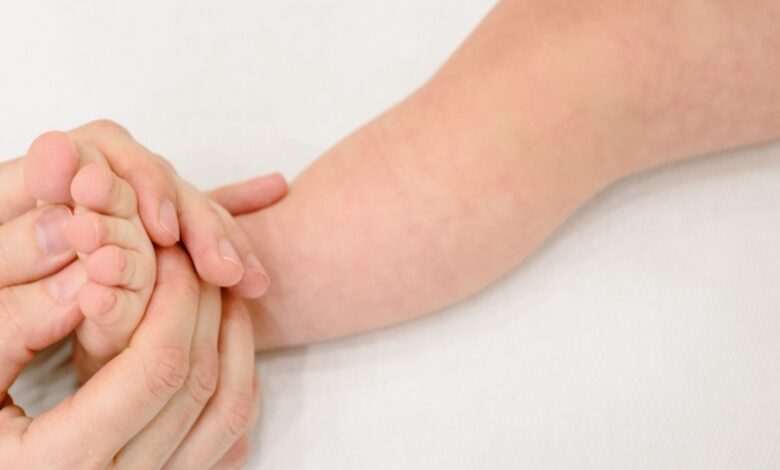 Skin Barrier Lemah Bikin Eksim Bayi Mudah Kambuh, Cara Menjaganya Bukan Sekadar Oles Pelembap