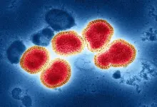 523 Suspek Flu Singapura Tersebar di Sumsel, Palembang Paling Tinggi