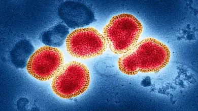 523 Suspek Flu Singapura Tersebar di Sumsel, Palembang Paling Tinggi