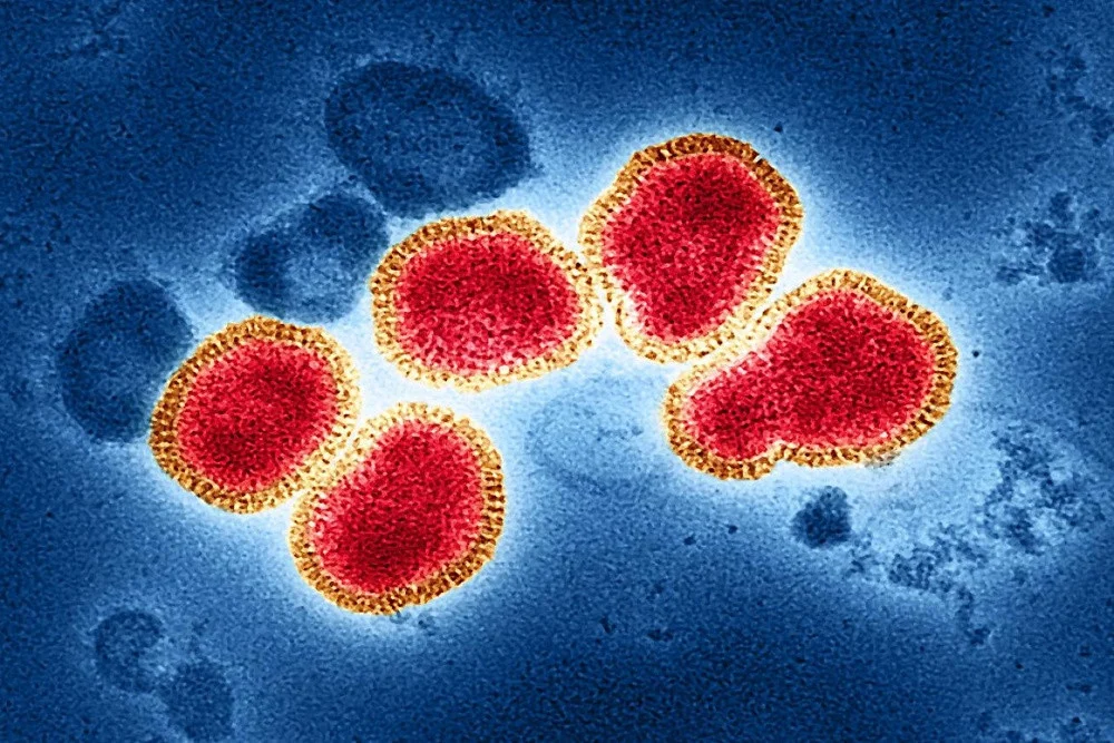 523 Suspek Flu Singapura Tersebar di Sumsel, Palembang Paling Tinggi