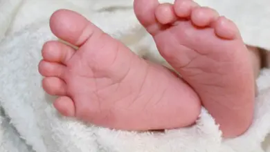 Gumoh Pada Bayi Tidak Selalu Berbahaya, Ini Tanda yang Harus Diwaspadai