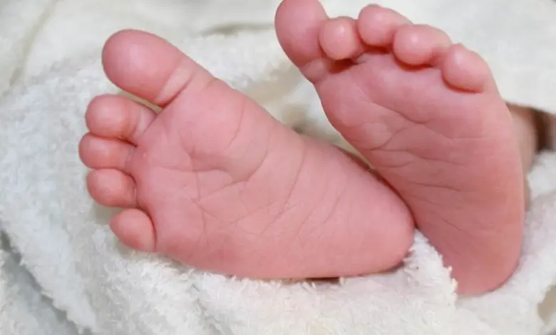 Gumoh Pada Bayi Tidak Selalu Berbahaya, Ini Tanda yang Harus Diwaspadai