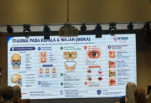 Trauma Kepala Bisa Langsung Mengancam Nyawa, Ini Tanda Bahaya yang Tak Boleh Diabaikan