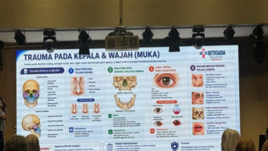Trauma Kepala Bisa Langsung Mengancam Nyawa, Ini Tanda Bahaya yang Tak Boleh Diabaikan